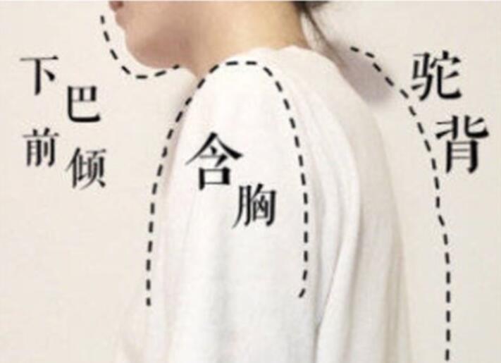 南寧美容學校：堅持一個月，駝背變直背