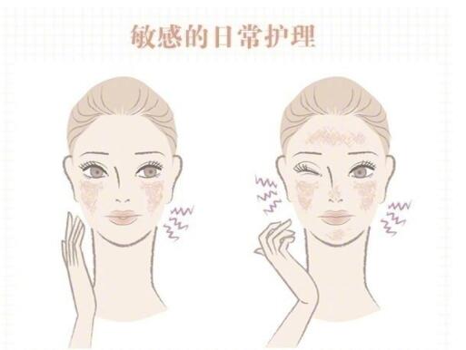 敏感肌保養(yǎng)大全！