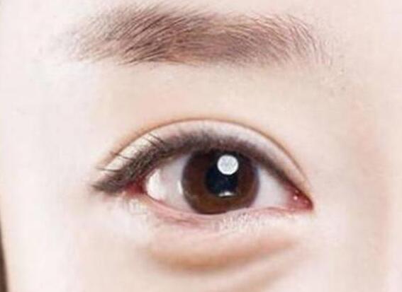 南寧美容學校福音：眼袋妹子有救了!