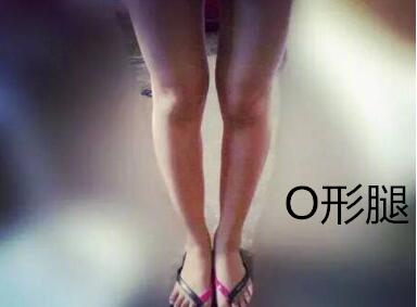 糾正你的腿型！