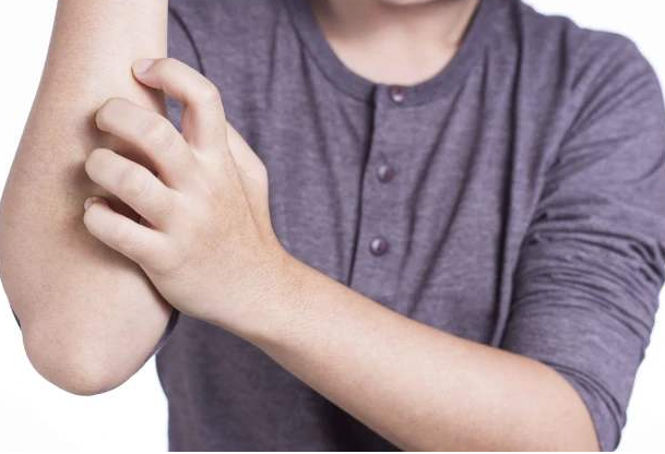 如何應對秋冬季節(jié)皮膚干燥瘙癢