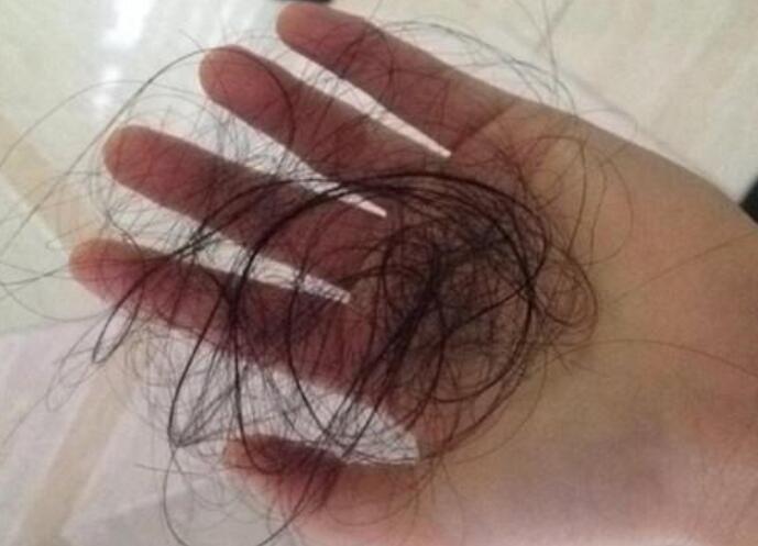 脫發(fā)女孩必備寶典！南寧美發(fā)學(xué)校教你