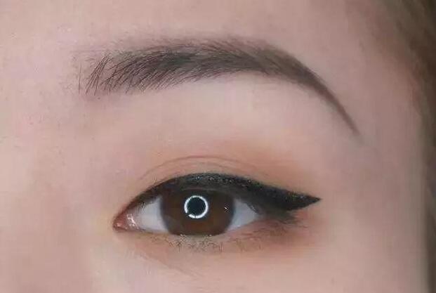 眼尾三角區(qū)怎么處理？