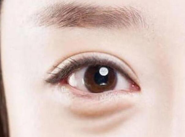 眼袋？淚溝？臥蠶？南寧美容學(xué)校教你辨別