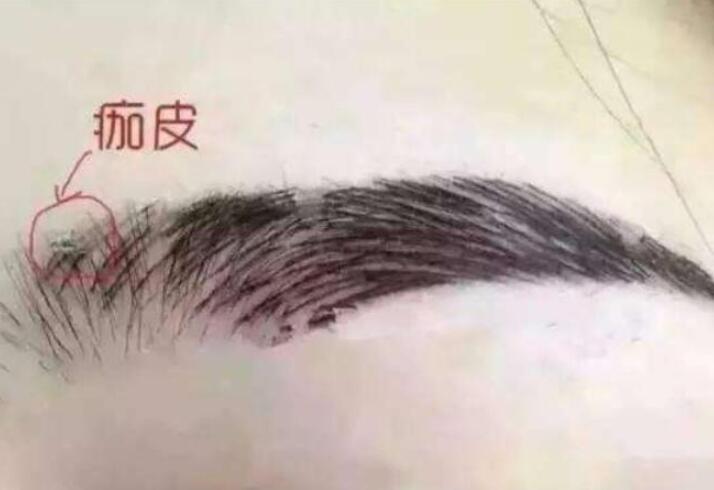 紋眉結(jié)痂時要注意什么？麗紋竹繡學校教你