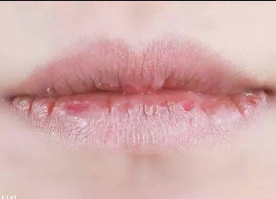 紋唇后嘴巴干燥怎么辦？南寧教紋繡的學校幫你解決