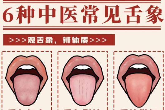 6種常見中醫(yī)舌診判定，快和廣西中醫(yī)美容一起學(xué)