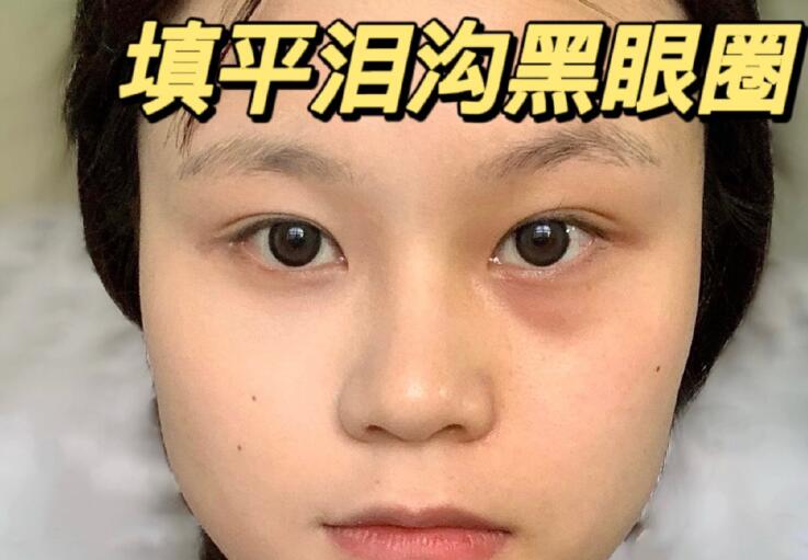 填平淚溝黑眼圈教程，廣西南寧化妝學(xué)校分享