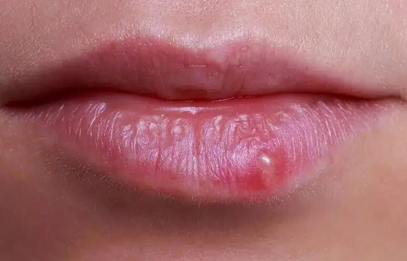 紋唇后起泡怎么辦？南寧紋唇培訓(xùn)學(xué)校教你方法