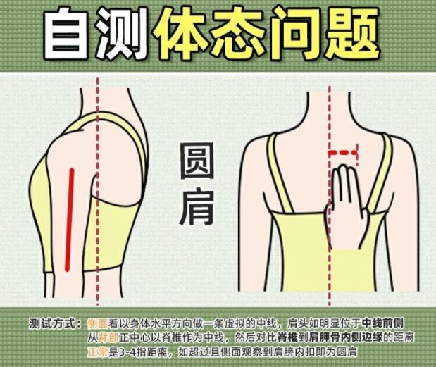 你真的是駝背嗎？廣西美容美體學校教你自測