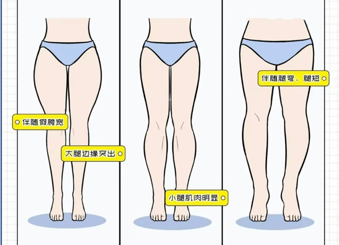 腿粗女生穿搭攻略，廣西彩妝造型搭配