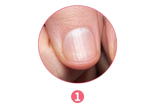 女生氣血不足六大表現(xiàn)，南寧美容養(yǎng)生資訊報道