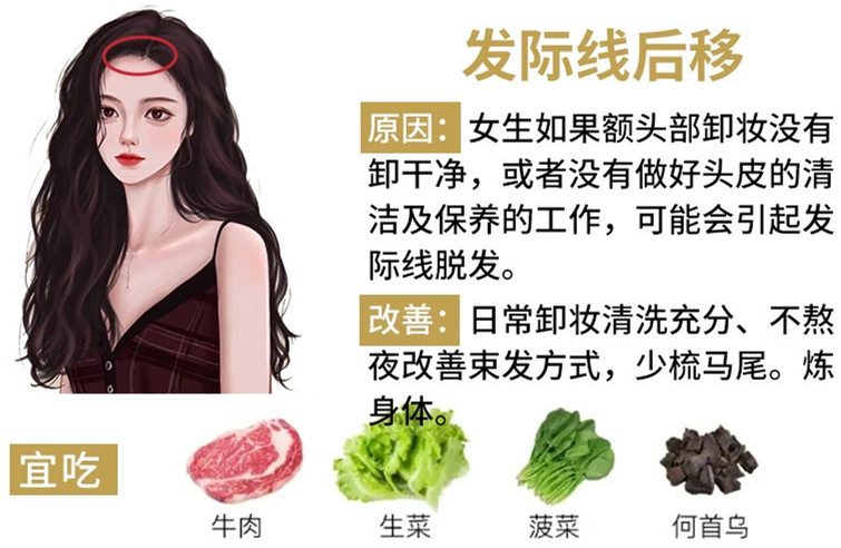 如何改善掉頭發(fā)？南寧頭療養(yǎng)發(fā)護(hù)發(fā)教學(xué)