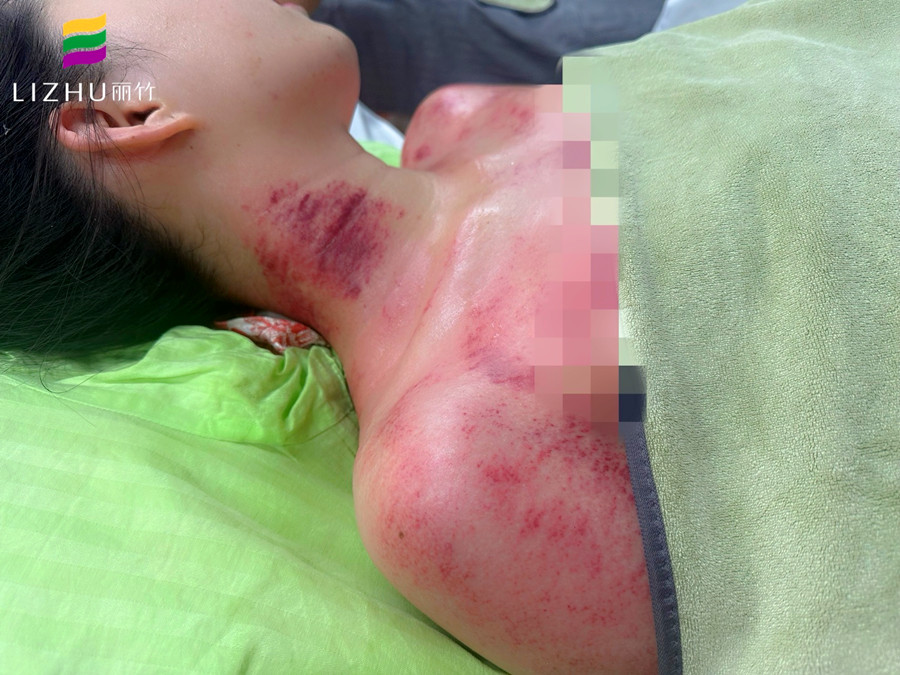 廣西學(xué)刮痧培訓(xùn)班 | 廣西學(xué)刮痧學(xué)費(fèi)多少？