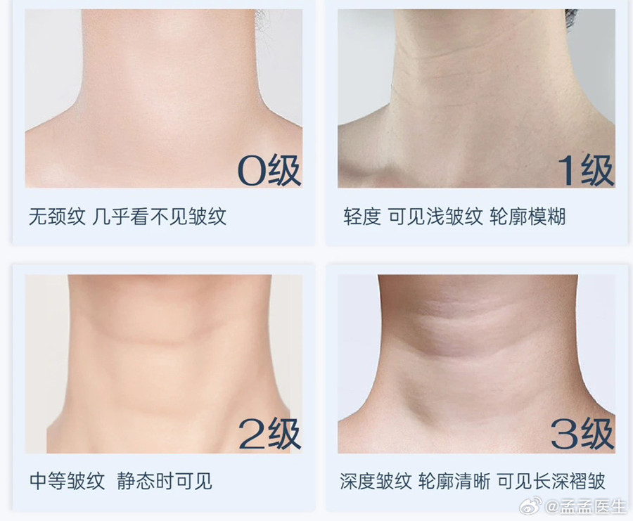 如何緩解頸紋？南寧美體美容管理培訓