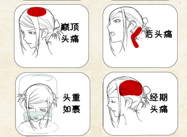 不同頭痛類型經(jīng)絡護理方法，廣西中醫(yī)美容培訓