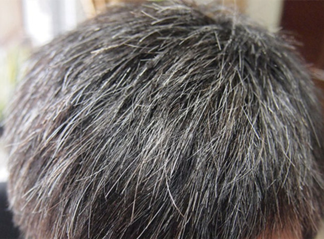 南寧美發(fā)基礎(chǔ)教學(xué)：為什么會(huì)長(zhǎng)白頭發(fā)？